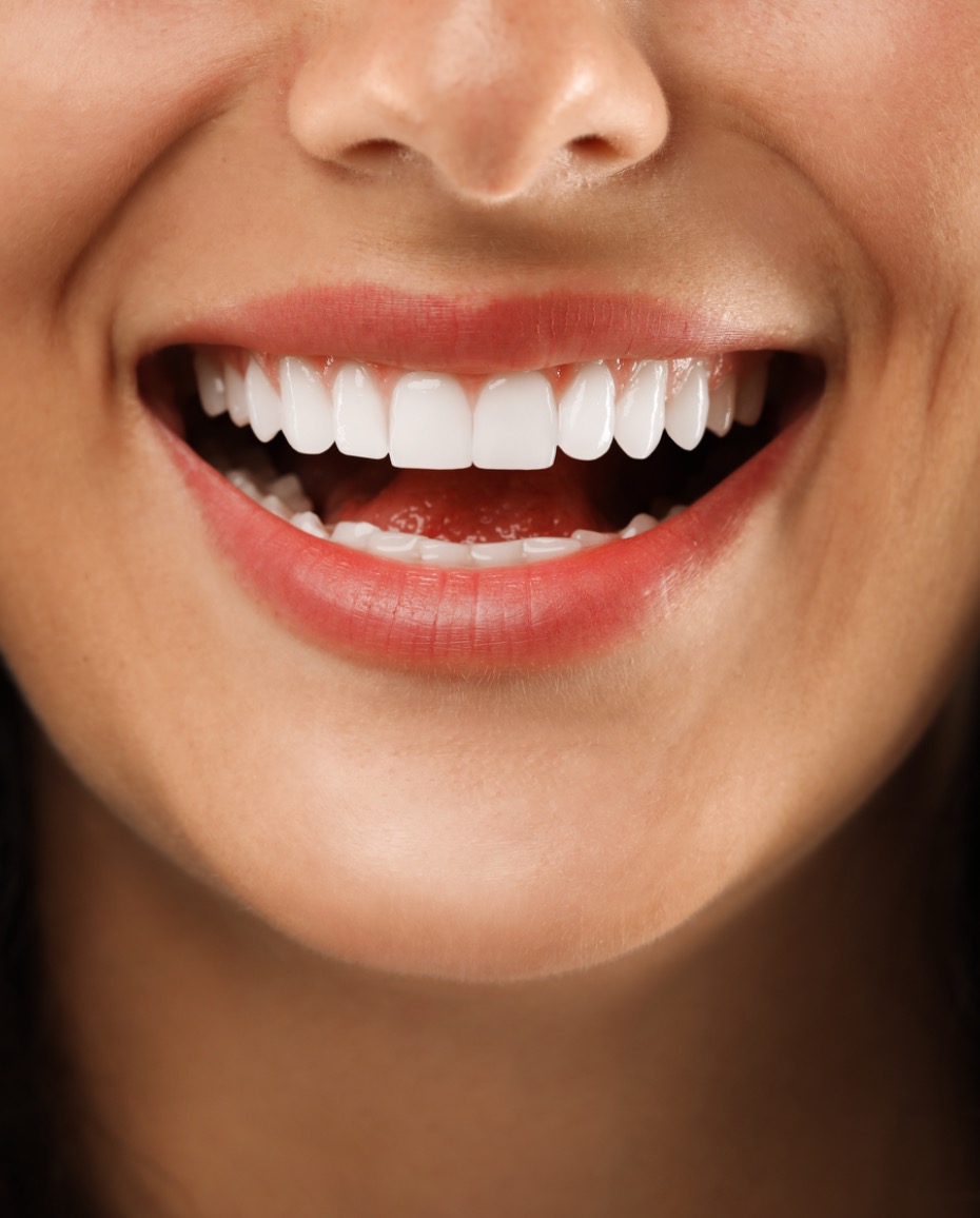 Quanto tempo dura o branqueamento dentário?